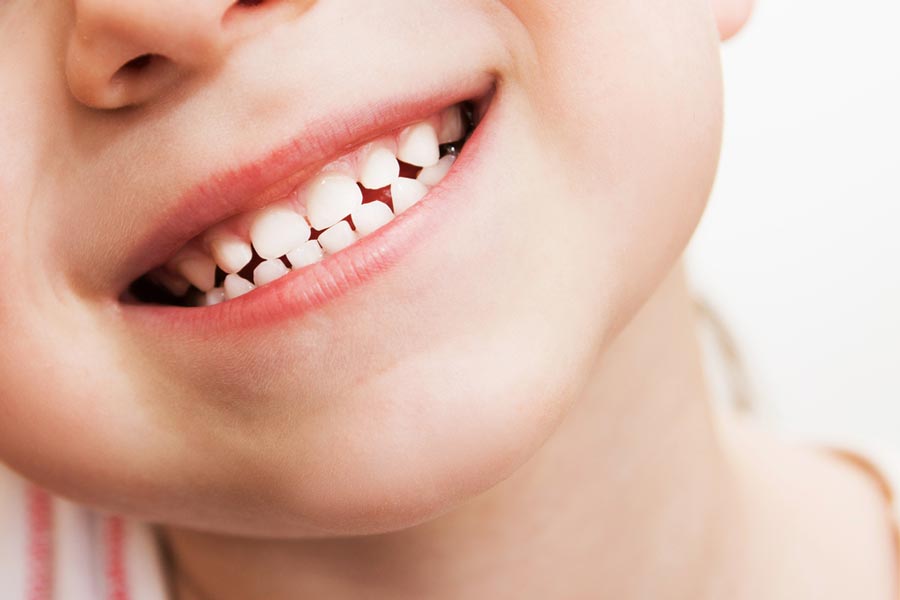 Kids teeth facts and how to avoid dental fluorosis